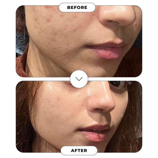 Bareskyn Moisturiser (fully loaded)